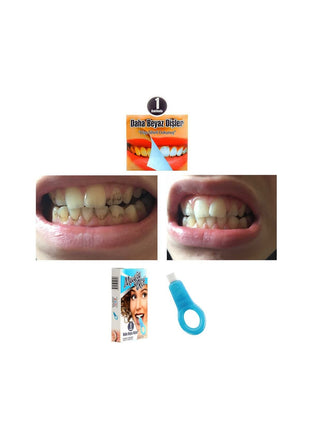 Diş Leke Silgisi 1 Aparatlı + 5 Yedek Süngerli Set X 2 Adet