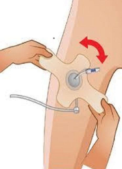 Kasık Kapama Pedi Angio Pad Anjiyo Ped