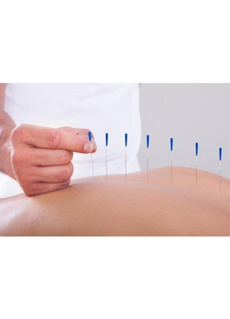 Akupunktur Iğnesikuru Iğne,acupuncture Needle 0,18*7mm