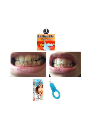 Diş Leke Silgisi 1 Aparatlı + 5 Yedek Süngerli Set X 5 Adet