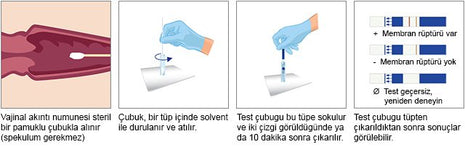 AmniSure Fetal Membran Yırtığı Testi